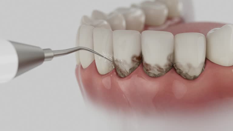 Reliable Dental contractor in Upper Sandusky, OH by Dentist Open Now